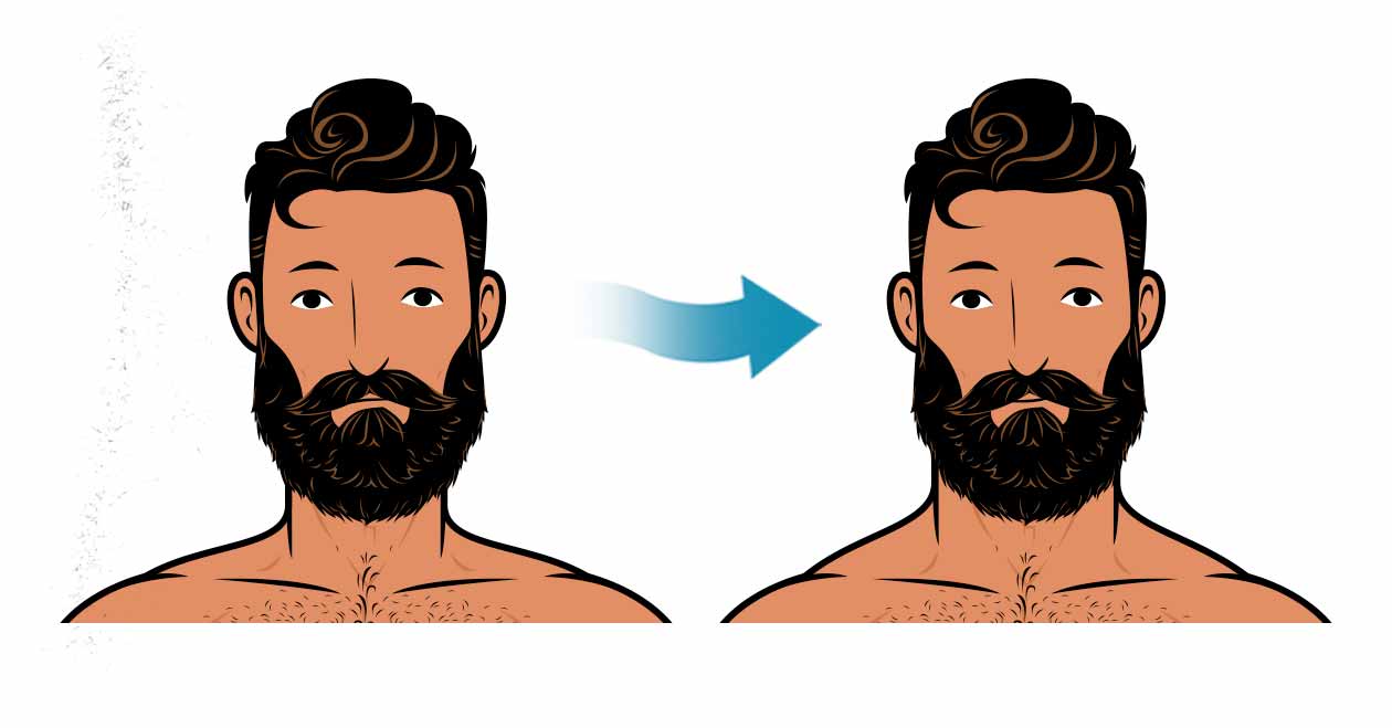 Ilustración del antes y después de un hombre al desarrollar un cuello más grueso.