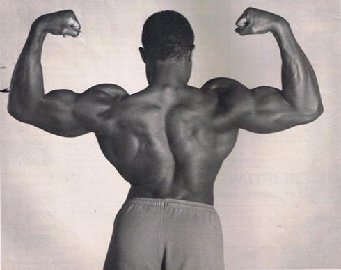 Foto de la espalda de Lamar Gant, quien sufría de escoliosis