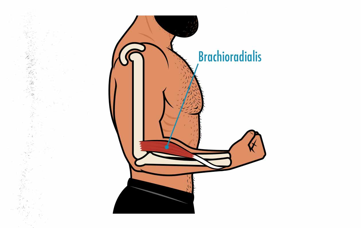 Diagram showing the anatomy of the brachioradialis muscle.