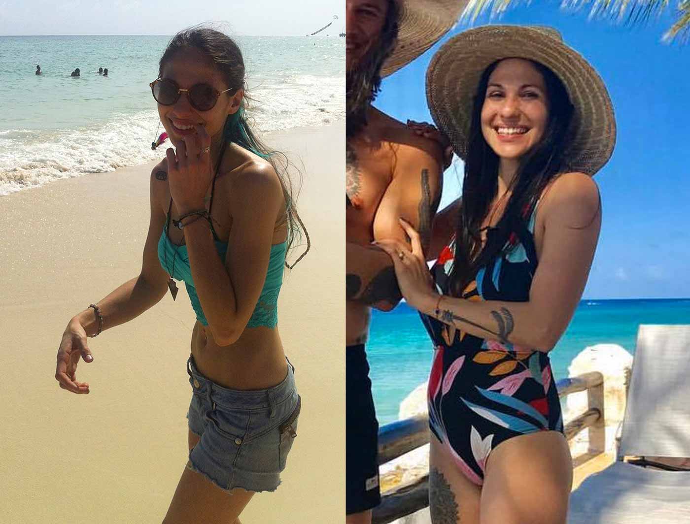 Fotos del antes y después de Cassandra.