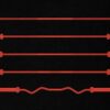 Illustration of the different types of barbells.